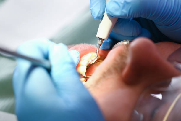 Best Broken or Chipped Tooth Repair in Henning, TN